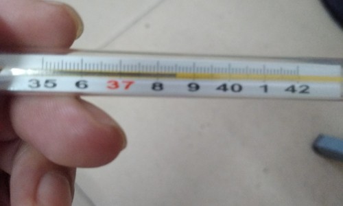 烧伤后激光治疗恢复过程-烧伤瘢痕点阵激光效果怎样网 :分享烧伤后激光治疗恢复过程-烧伤瘢痕点阵激光效果怎样知识